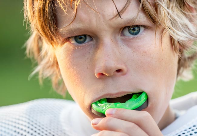 Sports Mouth Guard Dentist Holland MI